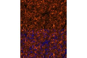 Immunofluorescence analysis of mouse pancreas using SERPINI2 Polyclonal Antibody (ABIN6131321, ABIN6147617, ABIN6147618 and ABIN6215429) at dilution of 1:100 (40x lens). (SERPINI2 anticorps  (AA 56-405))