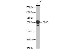 Western blot analysis of extracts of Jurkat cells, using CDK8 antibody (ABIN6129240, ABIN6138329, ABIN6138330 and ABIN7101776) at 1:1000 dilution. (CDK8 anticorps  (AA 365-464))