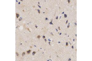 Immunohistochemistry of paraffin-embedded rat brain using PPP2R4 Antibody (ABIN5970981) at dilution of 1/200 (40x lens). (PPP2R4 anticorps)