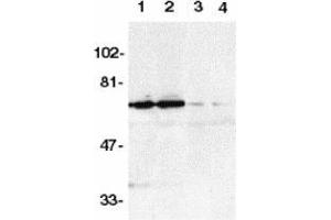 Western blot analysis of DR6 in K562 (1,3) and Raji (2,4) whole cell lysate in the absence (1,2) or presence (3,4) of blocking peptide with AP30301PU-N DR6 antibody at 1/500 dilution. (TNFRSF21 anticorps  (AA 42-56))