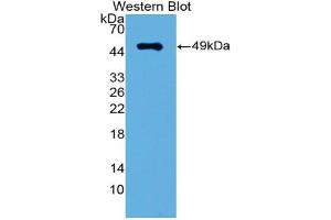 Western blot analysis of the recombinant protein. (IRF3 anticorps  (AA 1-406))