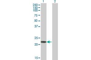 Western Blot analysis of RAB7B expression in transfected 293T cell line by RAB7B MaxPab polyclonal antibody. (RAB7B anticorps  (AA 1-199))