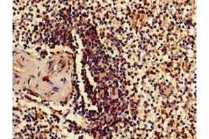 Immunohistochemistry of paraffin-embedded human spleen tissue using ABIN7142496 at dilution of 1:100