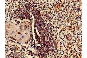 Immunohistochemistry of paraffin-embedded human spleen tissue using ABIN7142496 at dilution of 1:100 (RPS15 anticorps  (AA 63-137))