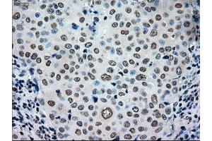 Image no. 2 for anti-TYRO3 Protein Tyrosine Kinase (TYRO3) antibody (ABIN1501607)