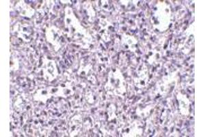 Immunohistochemistry of Carabin in human spleen tissue with Carabin antibody at 2.