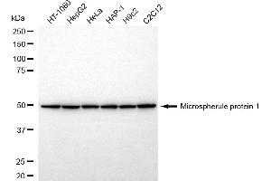 Western blotting analysis using microspherule protein 1 antibody (ABIN7799408).