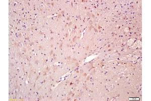 Formalin-fixed and paraffin embedded rat brain labeled with Anti-CNTF Polyclonal Antibody, Unconjugated (ABIN674229) at 1:200 followed by conjugation to the secondary antibody and DAB staining (CNTF anticorps  (AA 21-150))