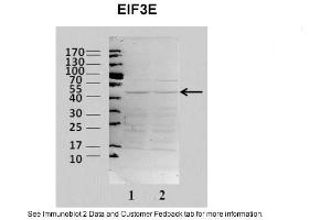 Sample Type: 2. (EIF3E anticorps  (N-Term))