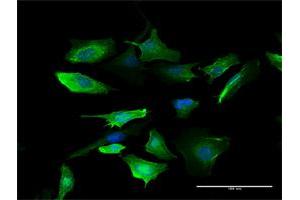 Immunofluorescence of purified MaxPab antibody to S100A10 on HeLa cell.