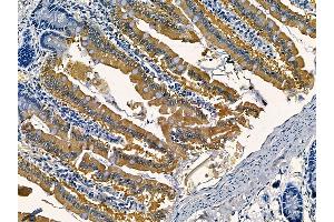 ABIN6265800 and ABIN6266909 at 1/100 staining rat colorectal tissue by IHC-P.