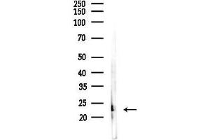 anti-Ubiquitin-Conjugating Enzyme E2E 2 (UBE2E2) (N-Term) antibody