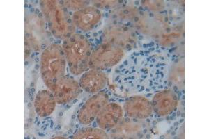 Used in DAB staining on fromalin fixed paraffin- embedded Kidney tissue (STAM2 anticorps  (AA 1-377))
