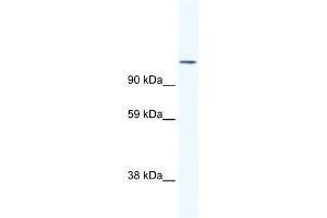 WB Suggested Anti-NFATC2 Antibody Titration:  1. (NFAT1 anticorps  (N-Term))