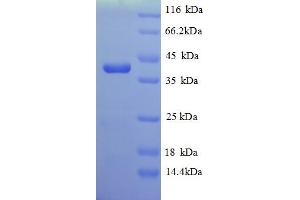 SDS-PAGE (SDS) image for Homocysteine S-Methyltransferase 1 (MHT1) (AA 1-324), (full length) protein (His tag) (ABIN5712896) (MHT1 Protein (AA 1-324, full length) (His tag))