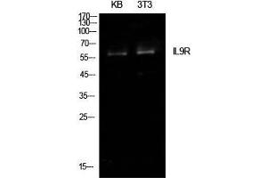 Western Blot (WB) analysis of KB, NIH-3T3 cells using IL-9R Polyclonal Antibody. (IL9 Receptor anticorps  (Internal Region))