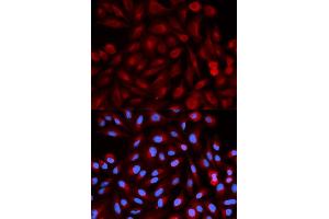 Immunofluorescence analysis of HeLa cells using PSME3 antibody. (PSME3 anticorps)