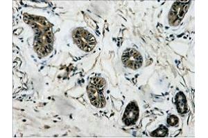 IHC Staining of Human colon tissue, diluted at 1:200.