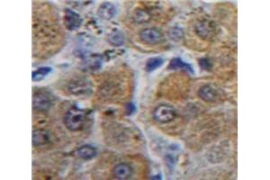 Used in DAB staining on fromalin fixed paraffin-embedded Liver tissue (aHSP anticorps  (AA 1-102))