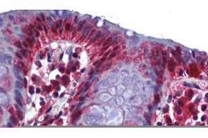human Colon (RBM47 anticorps  (Middle Region))