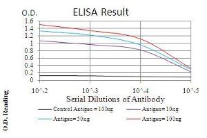 Black line: Control Antigen (100 ng), Purple line: Antigen(10 ng), Blue line: Antigen (50 ng), Red line: Antigen (100 ng), (TERT anticorps  (AA 1029-1132))