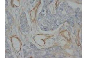 Image no. 1 for anti-Collagen, Type IV (COL4) antibody (Magnetic Particles) (ABIN1496273)