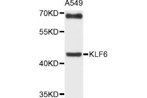 Western blot analysis of extracts of A-549 cells, using KLF6 antibody (ABIN4904165) at 1:1000 dilution. (KLF6 anticorps)