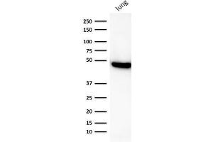 Western Blot Analysis of human lung lysate using CK19 Mouse Recombinant Monoclonal Antibody (rKRT19/800).
