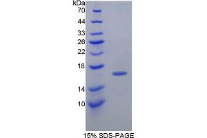 SDS-PAGE analysis of Guinea Pig Transthyretin Protein. (TTR Protéine)