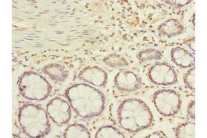 Immunohistochemistry of paraffin-embedded human colon tissue using ABIN7143116 at dilution of 1:100 (ACTRT1 anticorps  (AA 201-376))