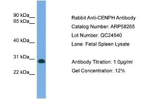 WB Suggested Anti-CENPH  Antibody Titration: 0. (CENPH anticorps  (N-Term))