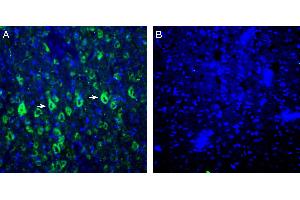 Expression of P2X6 in rat parietal cortex.