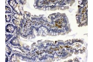 IHC testing of FFPE rat small intestine tissue with Calpain 2 antibody at 1ug/ml. (Calpain 2 anticorps)