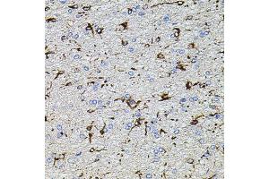Immunohistochemistry of paraffin-embedded rat brain using TRPA1 antibody (ABIN5996346) at dilution of 1/100 (40x lens). (TRPA1 anticorps)