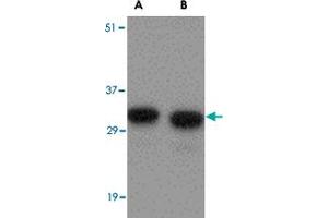 Western blot analysis of NIPSNAP1 in human brain tissue lysate with NIPSNAP1 polyclonal antibody  at (A) 0. (NIPSNAP1 anticorps  (Internal Region))