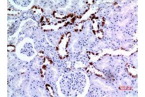 Immunohistochemistry (IHC) analysis of paraffin-embedded Human Kidney, antibody was diluted at 1:100.