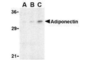 Western blot analysis of adiponectin in rat brain cell lysate with AP30023PU-N adiponectin antibody at (A) 1, (B) 2, and (C) 4 μg/ml. (ADIPOQ anticorps  (N-Term))