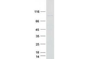 Validation with Western Blot