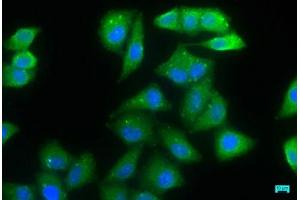 Immunofluorescence staining of Hela cells with ABIN7165849 at 1:66, counter-stained with DAPI. (NDRG1 anticorps  (AA 136-394))