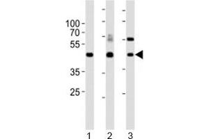 Western blot analysis of lysate from 1) mouse kidney, 2) mouse thymus and 3) rat lung tissue lysate using Dlk1 antibody. (DLK1 anticorps  (C-Term))
