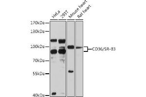 Western blot analysis of extracts of various cell lines, using CD36/SR-B3 antibody (ABIN3015504, ABIN3015505, ABIN1679086, ABIN5663919 and ABIN6218561) at 1:3000 dilution. (CD36 anticorps  (AA 301-400))