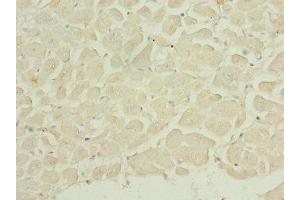Immunohistochemistry of paraffin-embedded human heart tissue using ABIN7150764 at dilution of 1:100 (DUSP22 anticorps  (AA 1-184))