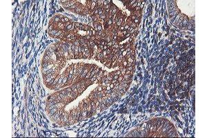 Image no. 7 for anti-phosphofructokinase, Platelet (PFKP) antibody (ABIN1500164)