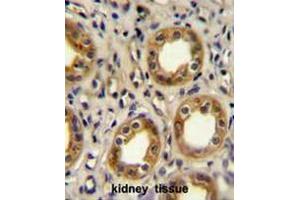CXCR3 Antibody (Center) immunohistochemistry analysis in formalin fixed and paraffin embedded human kidney tissue followed by peroxidase conjugation of the secondary antibody and DAB staining. (CXCR3 anticorps  (Middle Region))
