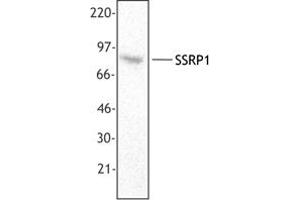 Image no. 1 for anti-Structure Specific Recognition Protein 1 (SSRP1) antibody (ABIN205478) (SSRP1 anticorps)