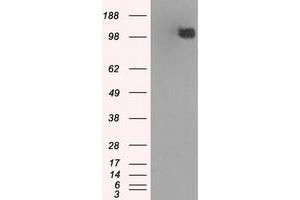 Image no. 11 for anti-Budding Uninhibited By Benzimidazoles 1 Homolog beta (Yeast) (BUB1B) antibody (ABIN1496996) (BUB1B anticorps)