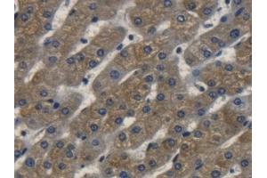 Detection of ErbB2 in Human Liver Tissue using Polyclonal Antibody to Receptor Tyrosine Protein Kinase erbB-2 (ErbB2)