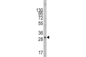 Western Blotting (WB) image for anti-KIT Ligand (KITLG) antibody (ABIN2998288) (KIT Ligand anticorps)