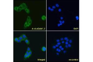 ABIN185301 Immunofluorescence analysis of paraformaldehyde fixed A431 cells, permeabilized with 0. (ADAM12 anticorps  (N-Term))