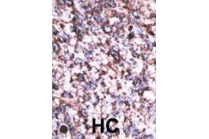 Immunohistochemistry (IHC) image for anti-beta-Site APP-Cleaving Enzyme 2 C (BACE2 C) antibody (ABIN2995239) (BACE2C anticorps)